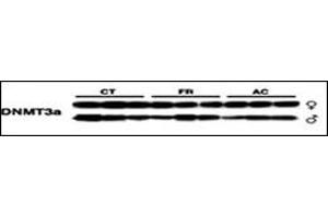 Lysates from mice thymus tissue after radiation were subjected to WB using antibody against DNMT3a. (DNMT3A antibody  (AA 457-486))