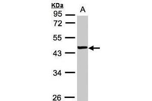 WB Image Sample(30 ug whole cell lysate) A:MOLT4 , 10% SDS PAGE antibody diluted at 1:1000 (VPS72 antibody)