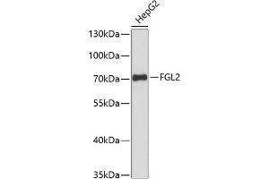 Western blot analysis of extracts of HepG2 cells, using FGL2 antibody (ABIN6130835, ABIN6140626, ABIN6140627 and ABIN6217862) at 1:3000 dilution. (FGL2 antibody  (AA 24-140))