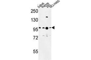 Western blot analysis of BCL11A Antibody (C-term) in Jurkat, Ramos, 293, NCI-H460 cell line lysates (35µg/lane).