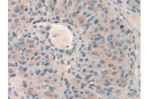 Detection of HPS4 in Mouse Ovary Tissue using Polyclonal Antibody to Hermansky Pudlak Syndrome Protein 4 (HPS4) (HPS4 antibody  (AA 20-214))