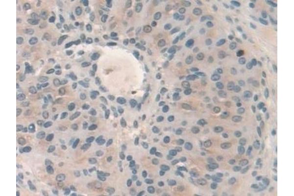 HPS4 antibody  (AA 20-214)
