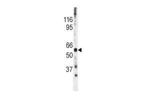 The anti-Phospho-CDC25A- Pab (ABIN389529 and ABIN2839577) is used in Western blot to detect Phospho-CDC25A- in mouse heart tissue lysate (CDC25A antibody  (pSer278))