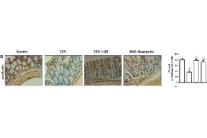 HQT regulates epithelial proliferation in the colonic mucosa of mice with DSS-induced acute and chronic colitis. (Occludin antibody  (AA 431-522))