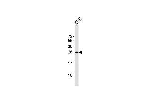 Lane 1: K562 Cell lysates, probed with RAB27A (1590CT813. (RAB27A antibody)