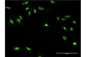 Immunofluorescence of monoclonal antibody to GAN on HeLa cell. (GAN antibody  (AA 534-597))