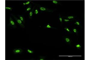 Immunofluorescence of monoclonal antibody to GAN on HeLa cell. (GAN antibody  (AA 534-597))