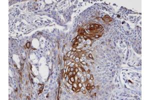 Immunohistochemistry (IHC) image for anti-Eukaryotic Translation Initiation Factor 4 gamma 2 (EIF4G2) (N-Term) antibody (ABIN2855137)