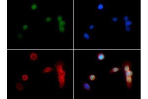 Fluorescence Microscopy (FM) image for anti-Histone 3 (H3) (H3K18me2) antibody (ABIN5706755)