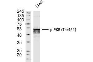 Mouse liver lysates probed with PKR(Thr451) Polyclonal Antibody, unconjugated  at 1:300 overnight at 4°C followed by a conjugated secondary antibody at 1:10000 for 90 minutes at 37°C. (EIF2AK2 antibody  (pThr451))