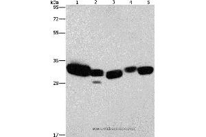 Western blot analysis of Mouse liver and human fetal lung tissue, hela cell and mouse kidney tissue, human brain malignant glioma tissue, using CBR1 Polyclonal Antibody at dilution of 1:900 (CBR1 antibody)