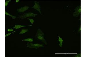 Immunofluorescence of monoclonal antibody to HHEX on HeLa cell. (HHEX antibody  (AA 133-237))