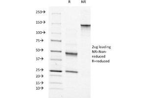 SDS-PAGE Analysis of Purified, BSA-Free Moesin Antibody (clone MSN/491).