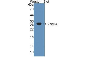 Figure. (A4GALT antibody  (AA 23-288))