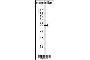 Western blot analysis of BTBD1 antibody in mouse cerebellum tissue lysates (35ug/lane) (BTBD1 antibody  (AA 295-322))