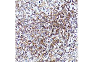 Immunohistochemistry of paraffin-embedded human appendix using Septin 1 antibody (ABIN7270202) at dilution of 1:100 (40x lens). (Septin 1 antibody  (AA 270-370))
