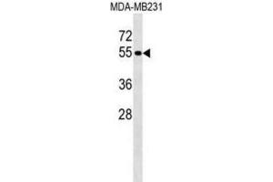 Western Blotting (WB) image for anti-Protein tyrosine Phosphatase, Non-Receptor Type 18 (Brain-Derived) (PTPN18) antibody (ABIN2999086)