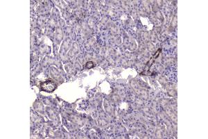 IHC analysis of CKB using anti-CKB antibody . (CKB antibody  (AA 7-381))