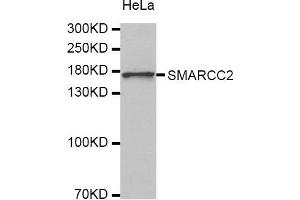 Western Blotting (WB) image for anti-SWI/SNF Related, Matrix Associated, Actin Dependent Regulator of Chromatin, Subfamily C, Member 2 (SMARCC2) antibody (ABIN1874865) (SMARCC2 antibody)