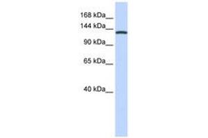 Image no. 1 for anti-Valyl-tRNA Synthetase (VARS) (C-Term) antibody (ABIN6740955) (VARS antibody  (C-Term))