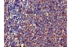 Immunohistochemistry of paraffin-embedded human lymph node tissue using ABIN7169238 at dilution of 1:100 (ERN1 antibody  (AA 493-561))