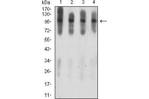 Western Blotting (WB) image for anti-Ataxin 1 (ATXN1) (AA 645-815) antibody (ABIN7193321)