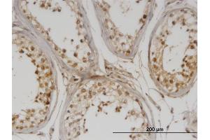 Immunoperoxidase of monoclonal antibody to DMAP1 on formalin-fixed paraffin-embedded human testis.