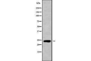 C-Type Lectin Domain Family 6, Member A (CLEC6A) (Internal Region) antibody