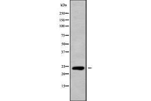 Western blot analysis of CLEC6A using HepG2 whole cell lysates (C-Type Lectin Domain Family 6, Member A (CLEC6A) (Internal Region) antibody)