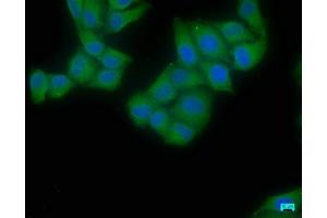 Immunofluorescence staining of Hela cells with ABIN7152176 at 1:50, counter-stained with DAPI. (EIF4G2 antibody  (AA 706-907))