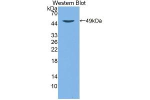 Detection of Recombinant TTPa, Mouse using Polyclonal Antibody to Alpha-Tocopherol Transfer Protein (TTPa) (TTPA antibody  (AA 88-253))