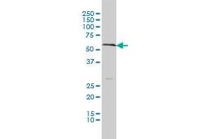 SLC18A1 monoclonal antibody (M01), clone 3A2-E10 Western Blot analysis of SLC18A1 expression in A-549 . (SLC18A1 antibody  (AA 1-493))