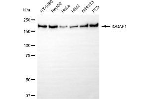 Western blotting analysis using IQGAP1 antibody (ABIN7799120).