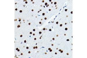 Immunohistochemistry (IHC) image for anti-FOS-Like Antigen 1 (FOSL1) (AA 1-100) antibody (ABIN6140738)