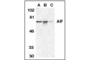 Western blot analysis of AIF in K562 cell lysate (A), mouse (B), and rat (C) liver tissue lysates with AIF antibody at 1 µg/ml.