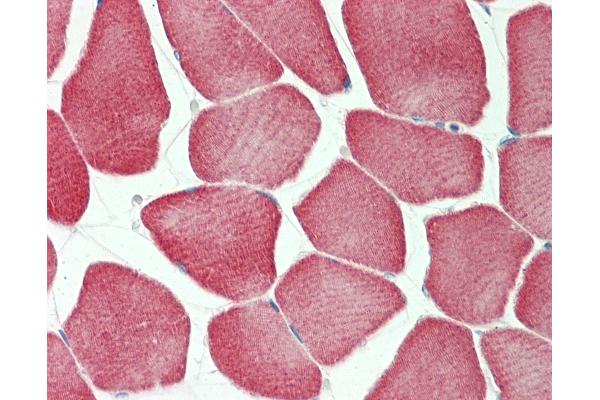 KBTBD13 antibody  (AA 409-438)