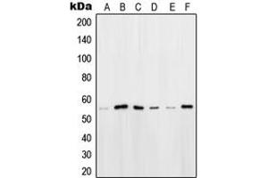 Western blot analysis of OCT2 expression in HeLa (A), HEK293T (B), Ramos (C), K562 (D), Raji (E), NIH3T3 (F) whole cell lysates. (Oct-2 antibody  (N-Term))