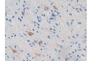 Immunohistochemistry (IHC) image for anti-Protein Kinase, AMP-Activated, beta 2 Non-Catalytic Subunit (PRKAB2) (AA 17-260) antibody (ABIN5014183)