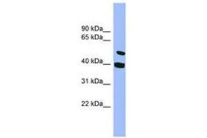 Image no. 1 for anti-Smu-1 Suppressor of Mec-8 and Unc-52 Homolog (SMU1) (AA 107-156) antibody (ABIN6744132) (SMU1 antibody  (AA 107-156))