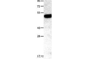 Western blot analysis of Mouse kidney tissue, using TNFRSF11B Polyclonal Antibody at dilution of 1:400
