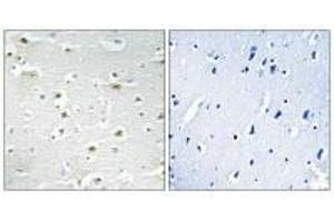 Immunohistochemistry analysis of paraffin-embedded human brain tissue using DDX3Y antibody. (DDX3Y antibody)