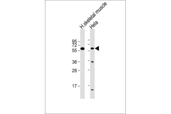 SLC29A2 Antikörper  (AA 1-31)