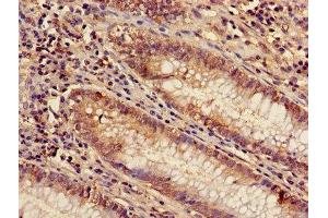 Immunohistochemistry of paraffin-embedded human colon tissue using ABIN7143509 at dilution of 1:100 (ARL4D antibody  (AA 2-201))