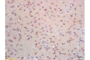 Formalin-fixed and paraffin embedded rat brain labeled with Rabbit Anti Histone H3-like protein Polyclonal Antibody, Unconjugated (ABIN670986) at 1:200 followed by conjugation to the secondary antibody and DAB staining (Centromeric Histone H3-Like Protein-2 (AA 51-145) antibody)