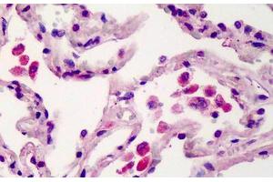 Human Lung: Formalin-Fixed, Paraffin-Embedded (FFPE) (TMEM123 antibody  (AA 173-188))
