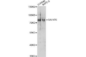 Western blot analysis of extracts of various cell lines, using GALNT6 antibody (ABIN6294086) at 1:1000 dilution.