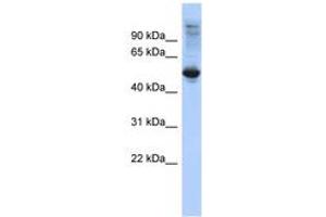 FBXL16 Antikörper  (C-Term)