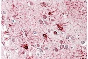AP23724PU-N (3. (GLUD1 antibody  (Internal Region))