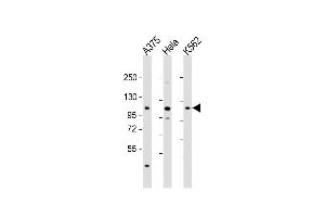 Western Blot at 1:2000 dilution Lane 1: A375 whole cell lysate Lane 2: Hela whole cell lysate Lane 3: K562 whole cell lysate Lysates/proteins at 20 ug per lane. (IDE antibody  (AA 406-435))