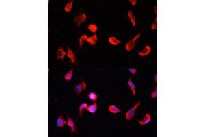 Immunofluorescence analysis of HeLa cells using CG Polyclonal Antibody (ABIN1678951, ABIN3017618, ABIN3017619 and ABIN6220165) at dilution of 1:100 (40x lens). (CAMKII gamma antibody  (AA 300-410))